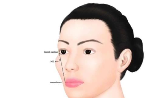 顴骨高動漫01.jpg 顴骨高動漫01.jpg