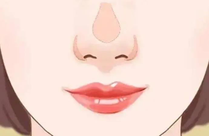 鼻頭肥大動(dòng)漫02.jpg 鼻頭肥大動(dòng)漫02.jpg