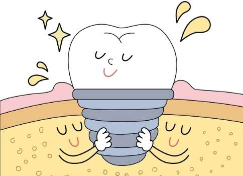 種牙植骨價格是多少？價格是在4000元到8萬元之間