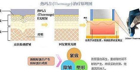 熱瑪吉h33.jpg 熱瑪吉h33.jpg