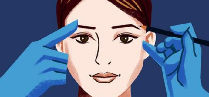 l雙眼皮u2.jpg l雙眼皮u2.jpg