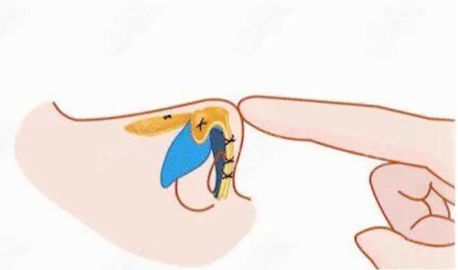 lbdm32.jpg lbdm32.jpg