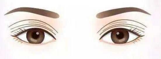 雙眼皮動漫31.jpg 雙眼皮動漫31.jpg