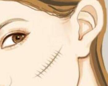 祛疤動漫02.jpg 祛疤動漫02.jpg