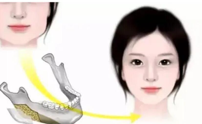 下頜角動(dòng)漫04.jpg 下頜角動(dòng)漫04.jpg