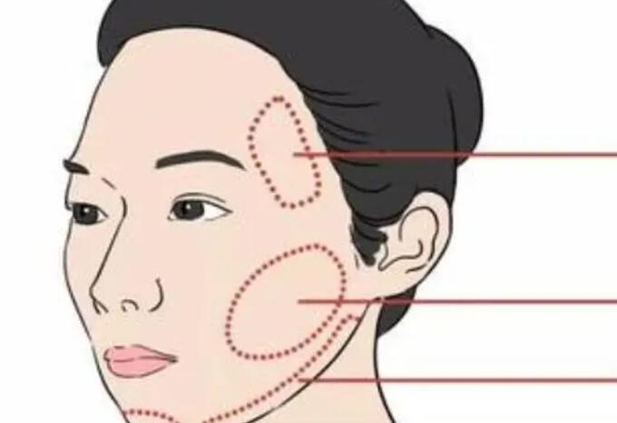 拉皮動(dòng)漫.jpg 拉皮動(dòng)漫.jpg