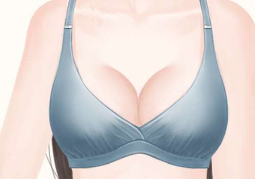 自體脂肪隆胸.jpg