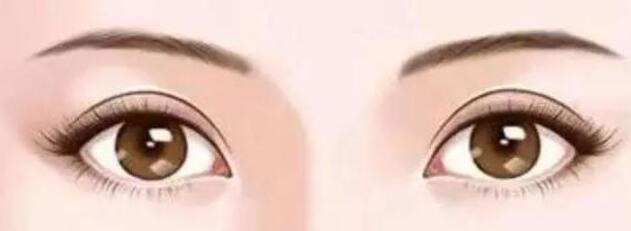 雙眼皮動漫30.jpg 雙眼皮動漫30.jpg