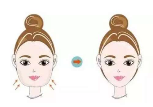 下頜 下巴 瘦臉.jpg