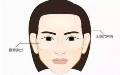 豐太陽穴動漫.jpg