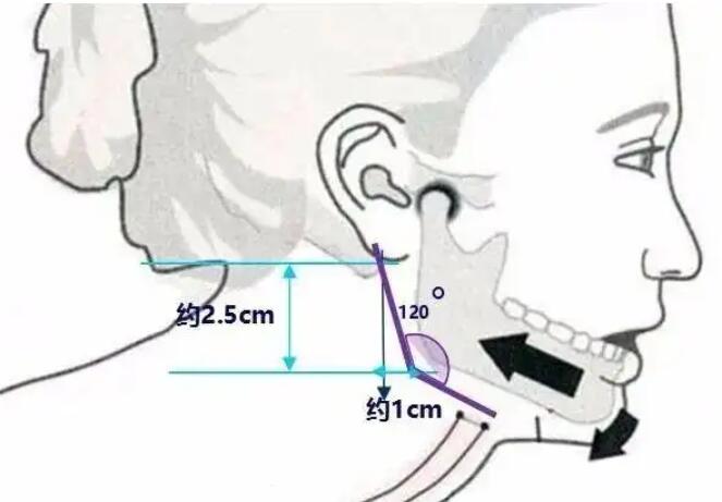 下頜角動(dòng)漫20.jpg 下頜角動(dòng)漫20.jpg