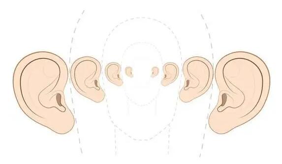 耳朵矯正動漫01.jpg 耳朵矯正動漫01.jpg