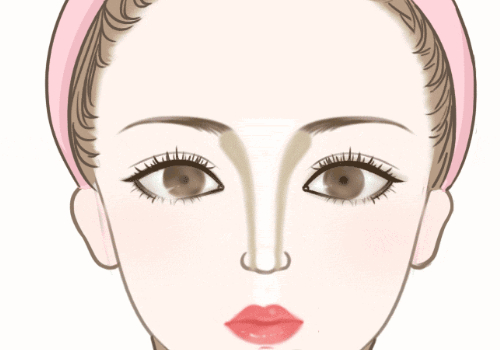 魏少魁做雙眼皮怎么樣?醫(yī)生簡(jiǎn)介、雙眼皮案例分享