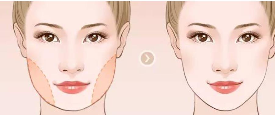 下頜角002.jpg 下頜角002.jpg