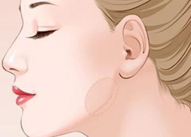 下頜角動(dòng)漫03.jpg 下頜角動(dòng)漫03.jpg