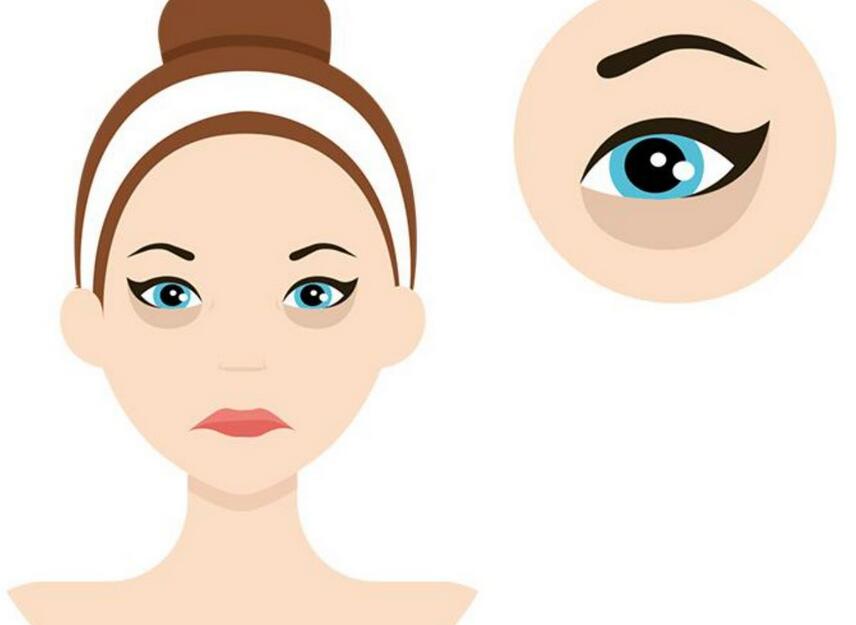 眼袋1.jpg 眼袋1.jpg