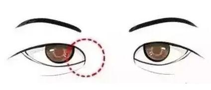 開眼角動(dòng)漫13.jpg 開眼角動(dòng)漫13.jpg