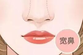 隆鼻動(dòng)漫42.jpg 隆鼻動(dòng)漫42.jpg