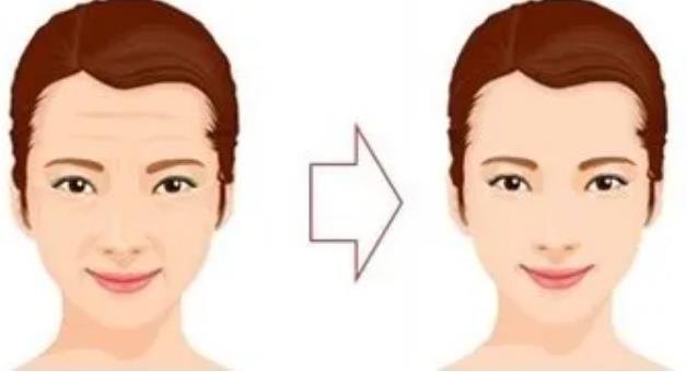 拉皮動(dòng)漫11.jpg 拉皮動(dòng)漫11.jpg