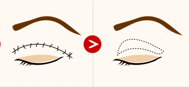 雙眼皮動漫44.jpg 雙眼皮動漫44.jpg