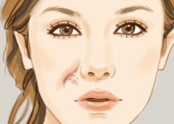 祛疤動(dòng)漫.jpg 祛疤動(dòng)漫.jpg