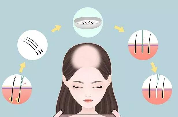 植發(fā)動漫24.jpg 植發(fā)動漫24.jpg