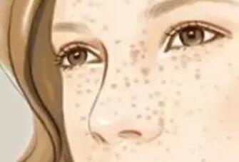 祛斑動(dòng)漫60.jpg 祛斑動(dòng)漫60.jpg