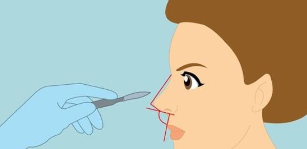 隆鼻動漫46.jpg 隆鼻動漫46.jpg