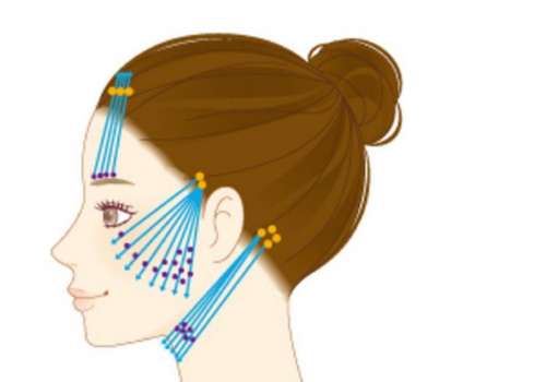 面部提升 (11).jpg