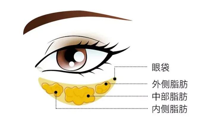 去眼袋動漫24.jpg 去眼袋動漫24.jpg