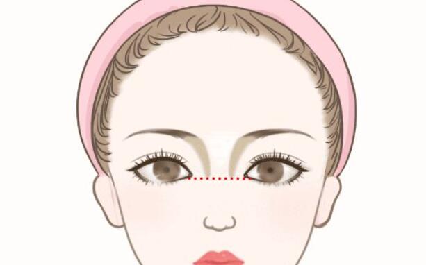 隆鼻動漫20.jpg 隆鼻動漫20.jpg