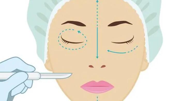 雙眼皮動漫56.jpg 雙眼皮動漫56.jpg