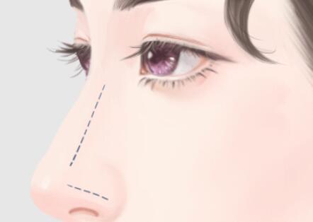 北京協(xié)和醫(yī)院龍飛隆鼻怎么樣？分享專家資料，含坐診醫(yī)院簡介