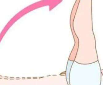 大腿吸脂 大腿吸脂