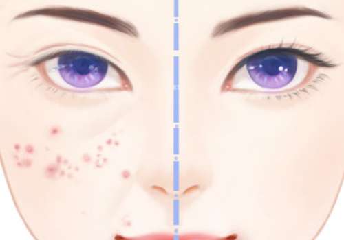 杭州市第三人民醫(yī)院光子嫩膚多少錢?內(nèi)含醫(yī)院簡介及醫(yī)生信息