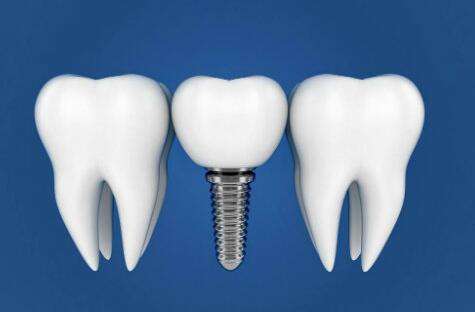 寧波第一醫(yī)院種植牙好不好？醫(yī)院信息在線分享，附特色項目簡介