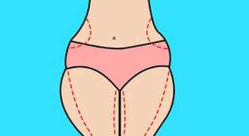 廣州美貝爾大腿吸脂的女人日記 分享！來看看前后差別大不大吧