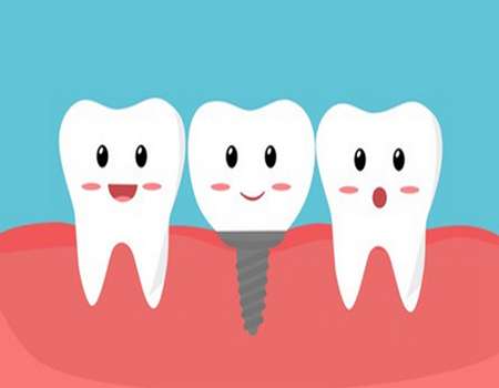 長沙中諾口腔種植牙價(jià)格表一覽？種植牙價(jià)格為5000元起