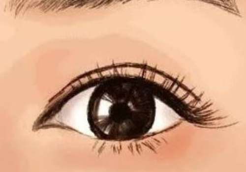 成都二醫(yī)院美容科割雙眼皮價格是多少?價格詳情及熱門項目一覽