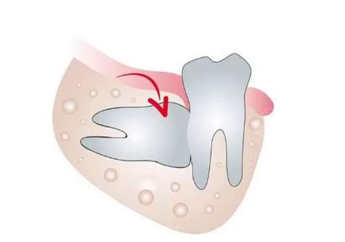 南方醫(yī)科大學(xué)第三附屬醫(yī)院口腔科拔智齒多少錢?內(nèi)附醫(yī)院簡介及醫(yī)生信息