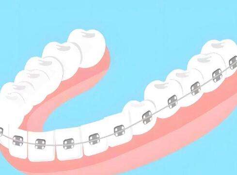 寧波第一醫(yī)院牙齒矯正掛什么科？附科室信息、口碑如何？