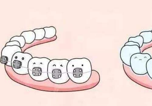 武漢協(xié)和牙齒矯正收費(fèi)貴嗎?醫(yī)院簡介及熱門項(xiàng)目公布