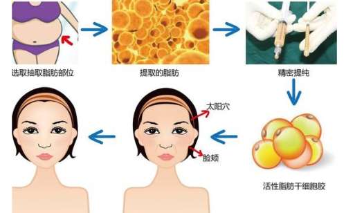 重慶三甲脂肪填充醫(yī)院排名,人氣醫(yī)院排名披露