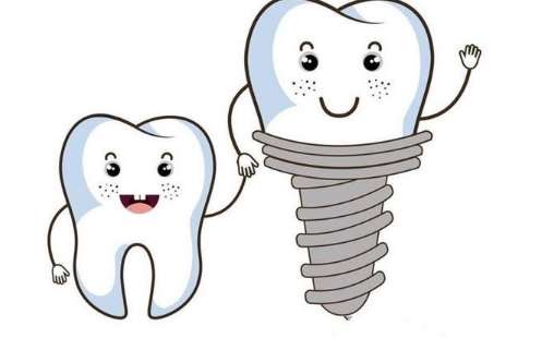 沈陽(yáng)種牙價(jià)格一般多少錢(qián)？?jī)r(jià)格比較合適，是從2000多元起