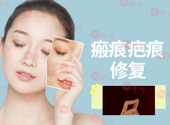 除疤痕最有效的方法，激光治療、碳酸鈣注射、纖維蛋白填充…