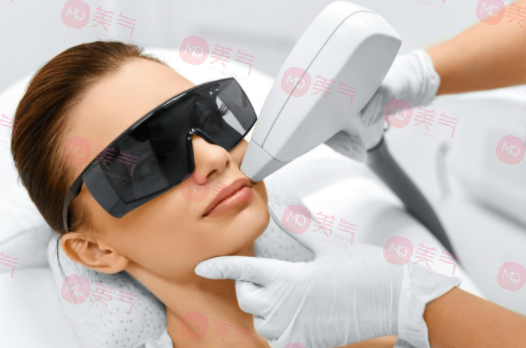 激光美容