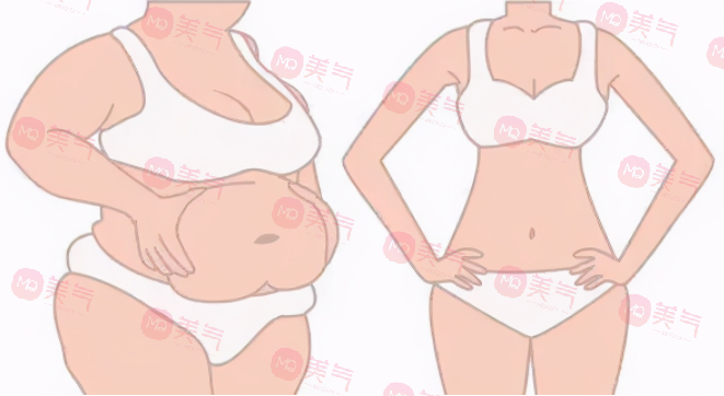 上海九院抽脂哪個醫(yī)生好？