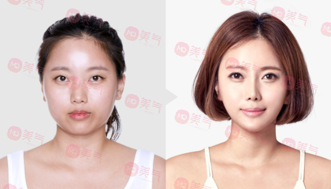 成都友誼醫(yī)院整形科擅長項(xiàng)目科普 成都友誼醫(yī)院整形科擅長項(xiàng)目科普