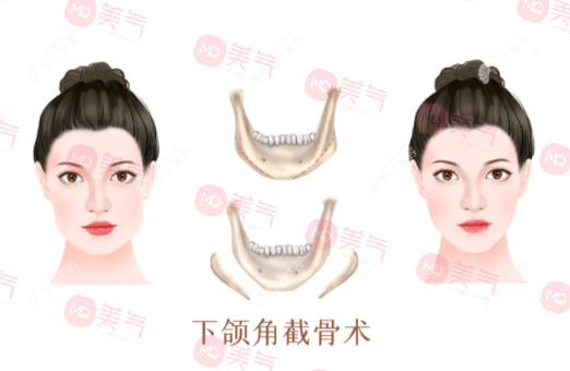 上海首爾麗格醫(yī)療美容醫(yī)院熱門項(xiàng)目