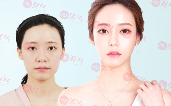 北京八大處整容醫(yī)院做輪廓整形多少錢？